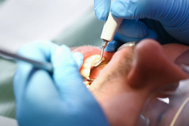 Best Urgent Care for Lost Fillings or Crowns in Belvedere, SC