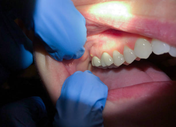 Best Weekend Emergency Dentist in Belvedere, SC