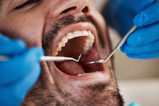 Best Emergency Treatment for Dental Infections or Abscesses in Belvedere, SC