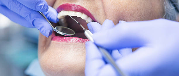 Best Emergency Tooth Extraction in Belvedere, SC